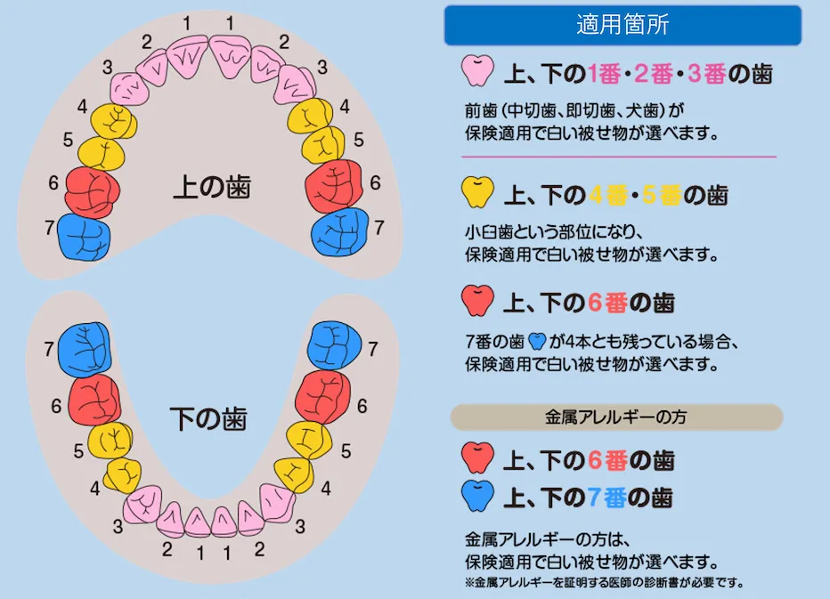 CAD/CAM冠適用箇所