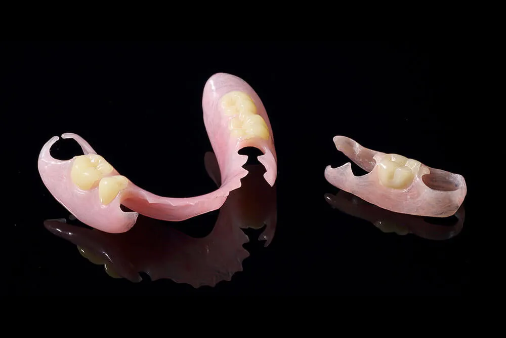 ノンクラスプデンチャー