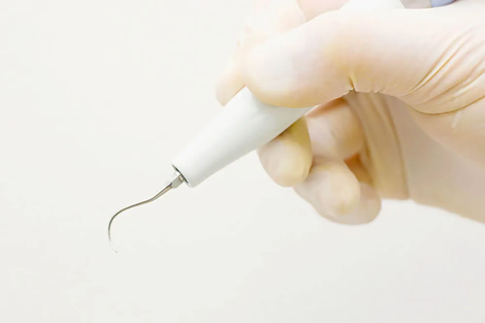 歯石除去とクリーニング